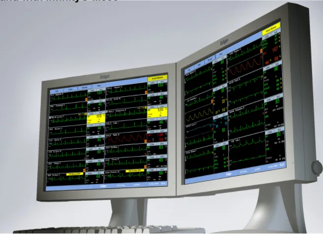 المحطة المركزية لأجهزة مراقبة المريض، 16 مريض