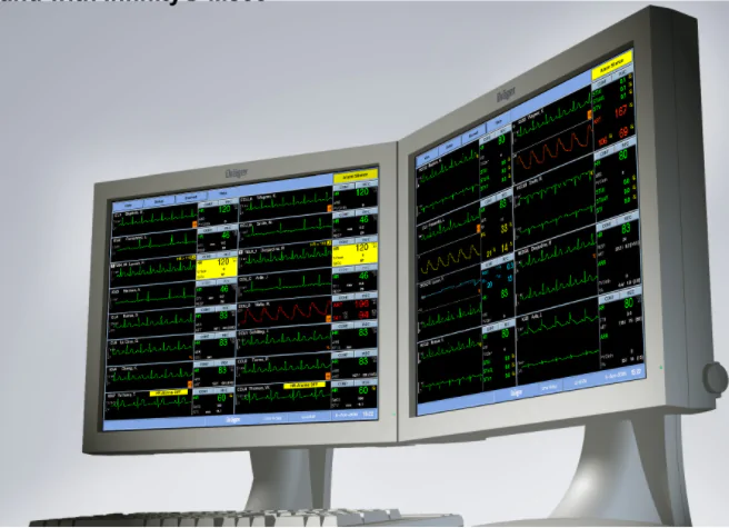 المحطة المركزية لأجهزة مراقبة المريض، 16 مريض